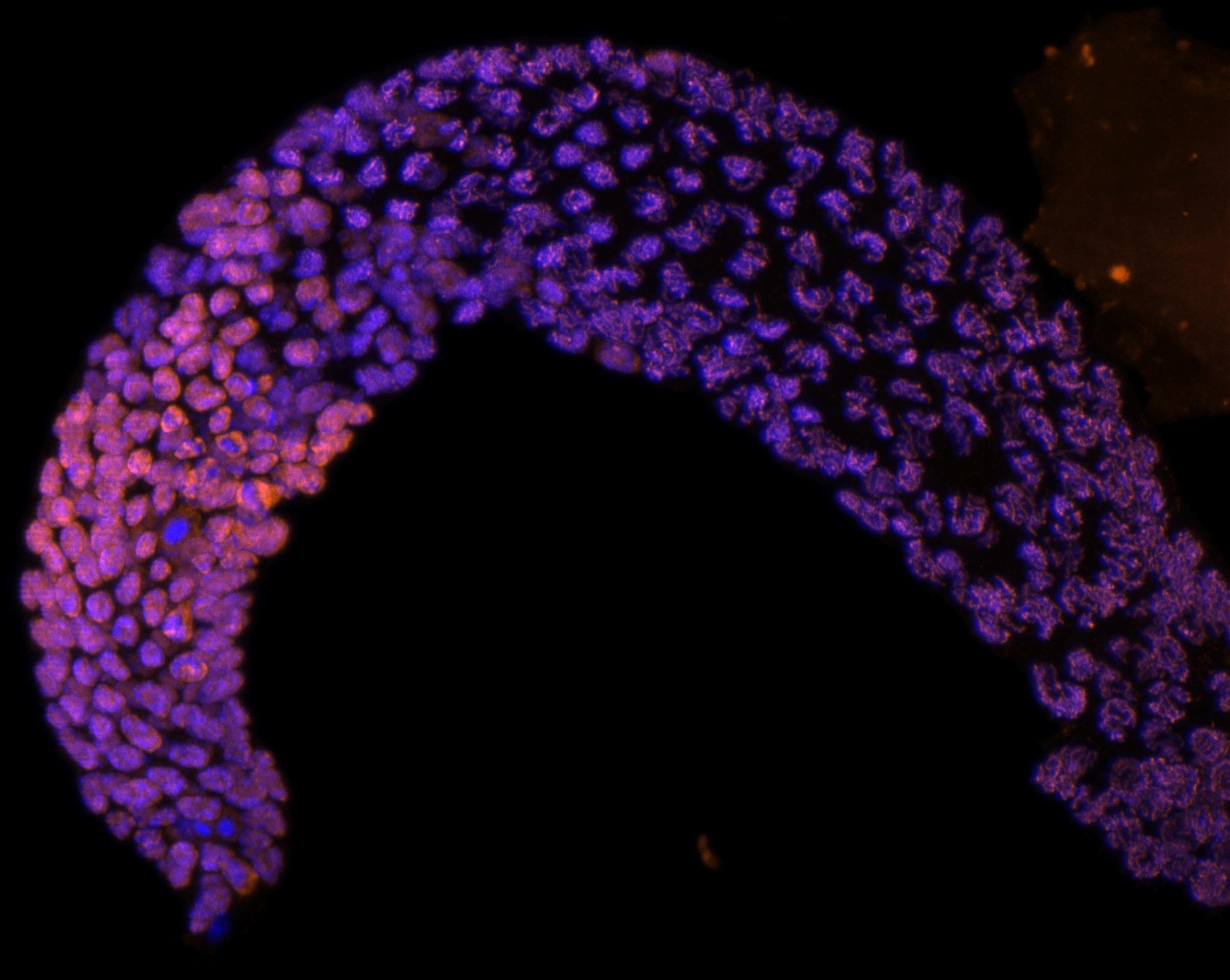 Merged DAPI and REC-8 image of a C. elegans germline