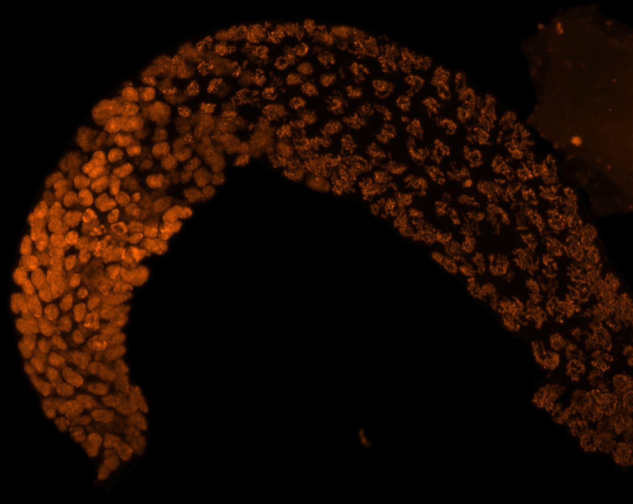 C. elegans germline stained for REC-8